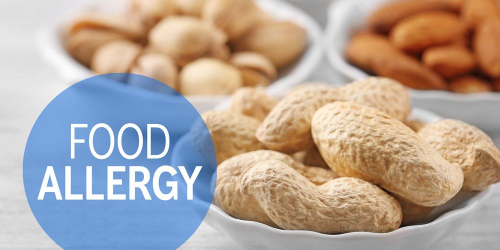 Food allergy myths