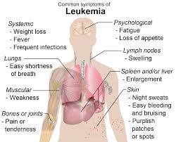 leukemia1