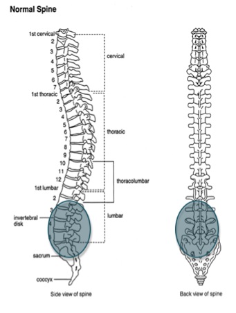 ankylosing spondylitis