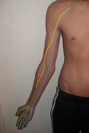 Brachial plexus injuries