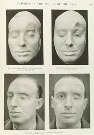 Facial injuries and diseases