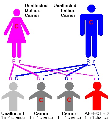 Tay-Sachs Disease