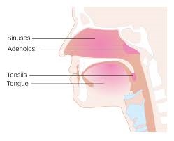 Tonsils and adenoids