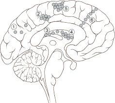 Tuberous sclerosis complex (TSC)