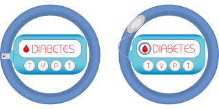 Type 1 diabetes