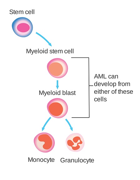 leukemia2