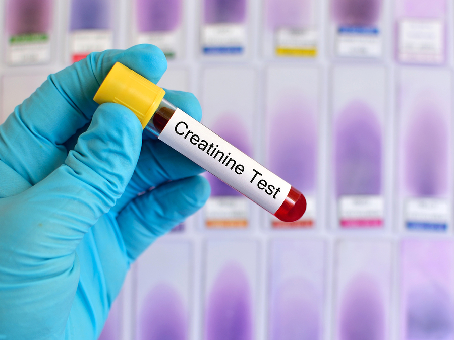 kidney tests