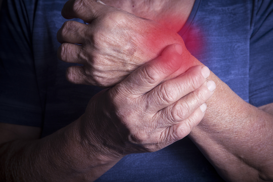 Rheumatoid Arthritis