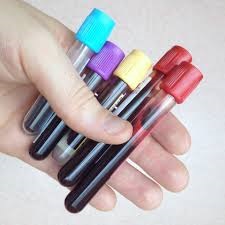 blood tests