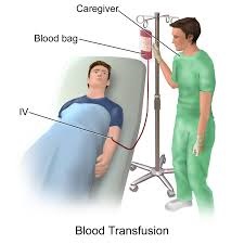 blood trasfusion