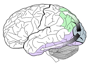 impairment cognitive Mild