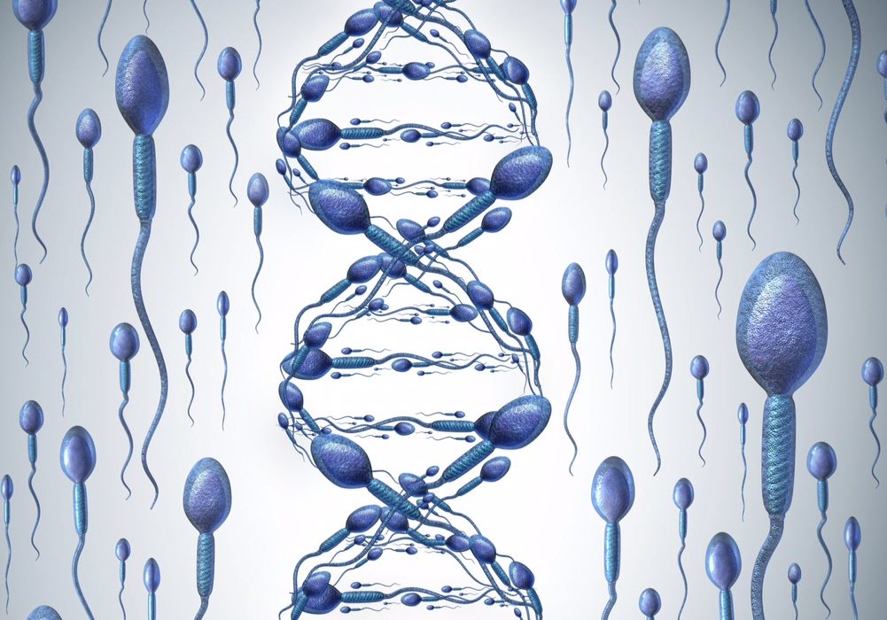 DFI, DNA Fragmentation Index