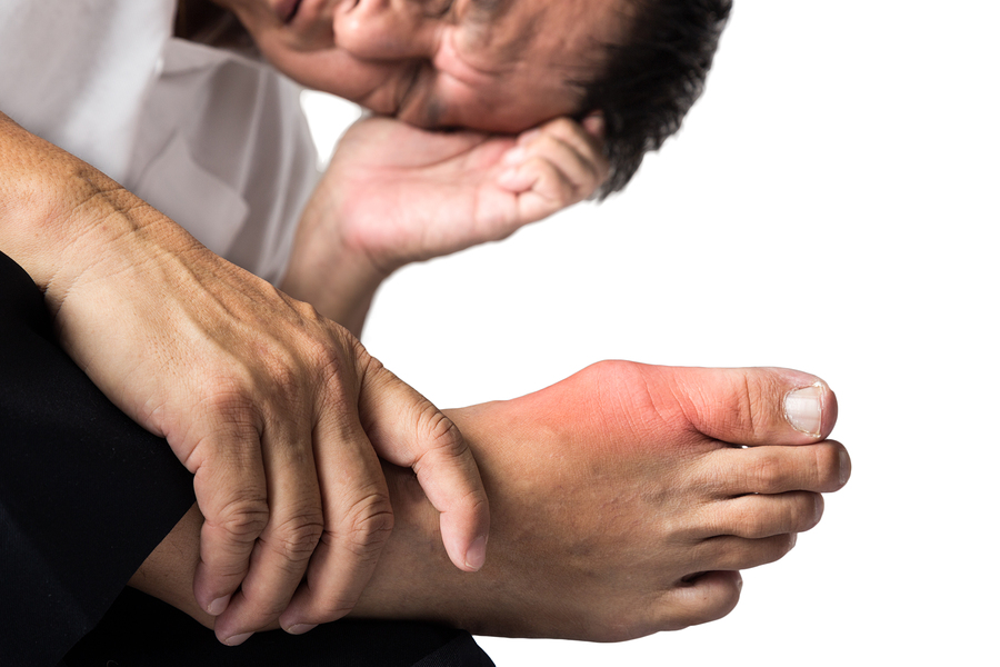 Gout Man with painful and inflamed feet