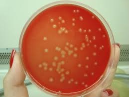 streptococcal infections