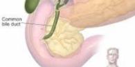 Gallbladder Disease