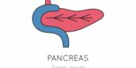 pancreas transplant