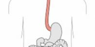 esophageal disorders